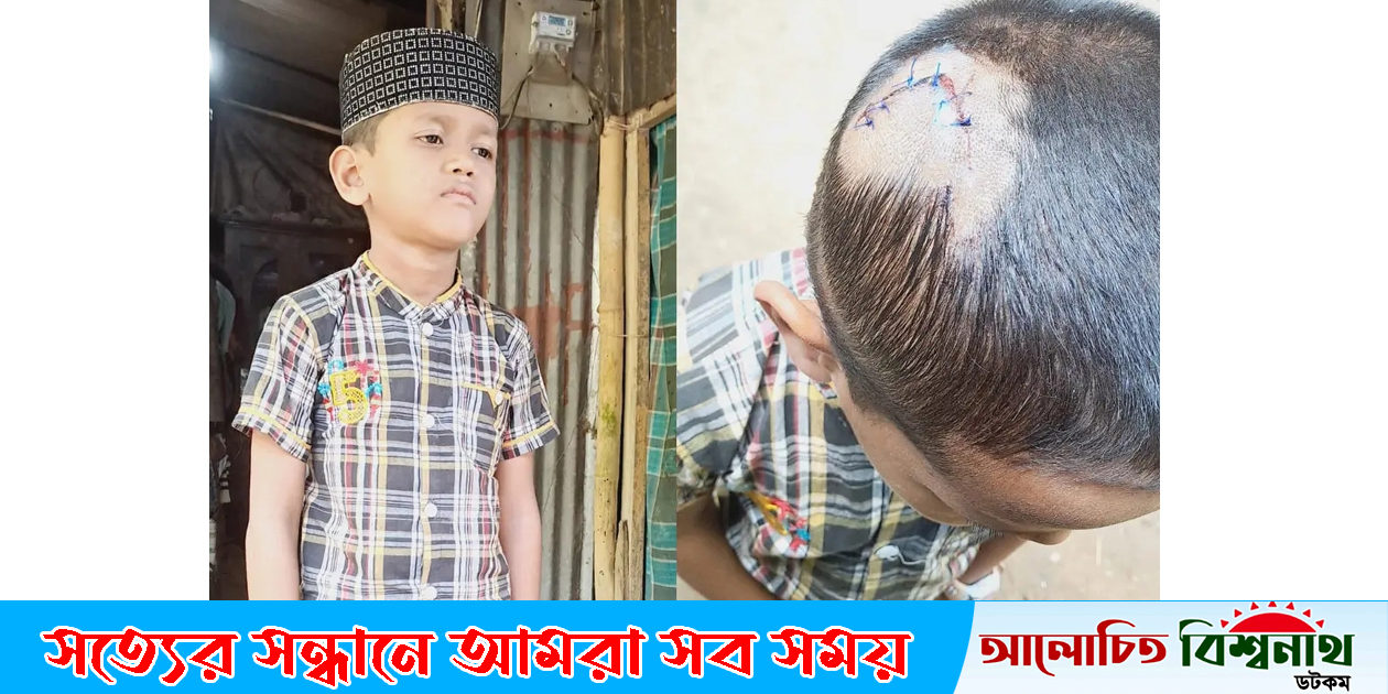 জুড়ীতে নিরাপত্তা বেষ্টনী না থাকায় নির্মাণ যন্ত্র মাথায় পড়ে শিশু শিক্ষার্থী আহত