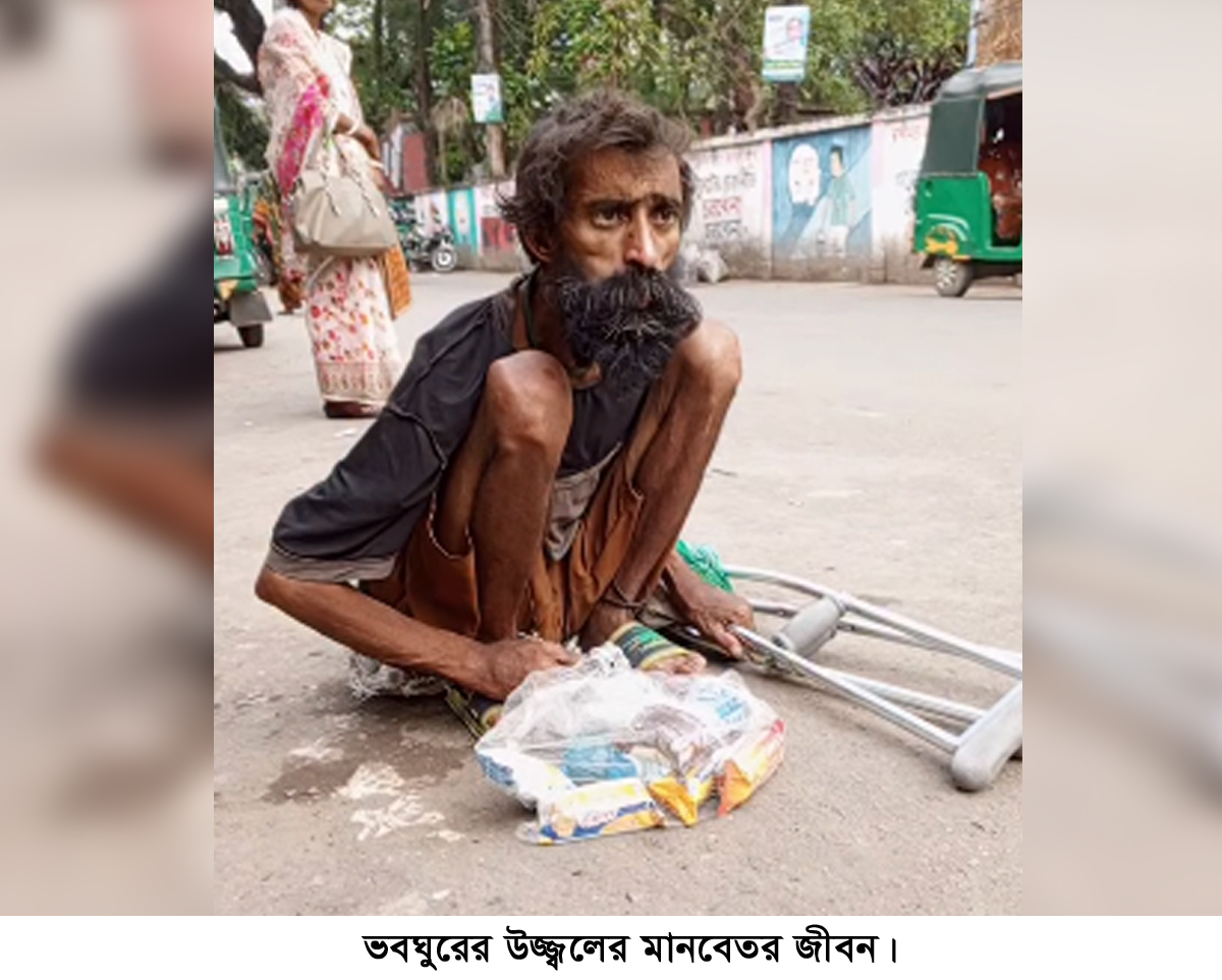 বিশ্বনাথে ভবঘুরে উজ্জ্বলের মানবেতর জীবন, প্রয়োজন সু-চিকিৎসার